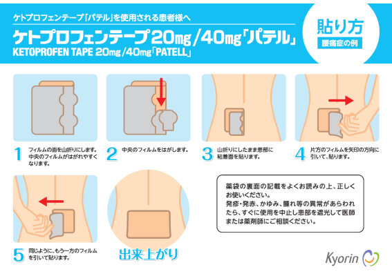 210127KETOPROFEN-PATELL_img1.jpg
